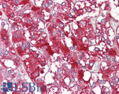 Anti-MYCBP Antibody (C-Terminus) IHC-plus LS-B8043