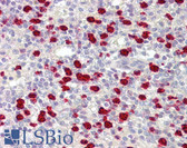 Anti-ZNF746 / PARIS Antibody (aa395-444) IHC-plus LS-B8045