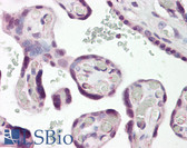 Anti-DLX3 Antibody (N-Terminus) IHC-plus LS-B8046