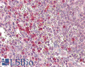 Anti-SIRT3 / Sirtuin 3 Antibody (C-Terminus) IHC-plus LS-B8047