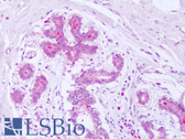 Anti-SDCBP / Syntenin Antibody (N-Terminus) IHC-plus LS-B8049