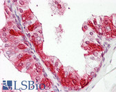 Anti-ZNF385A / ZNF385 Antibody (N-Terminus) IHC-plus LS-B8062