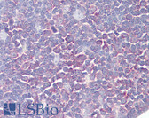 Anti-PTK2B / PYK2 Antibody (aa812-861) IHC-plus LS-B8064