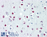 Anti-WHSC1 / NSD2 Antibody (aa219-268) IHC-plus LS-B8065