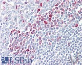 Anti-PARP6 Antibody (aa431-480) IHC-plus LS-B8067