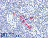 Anti-CHST4 / GlcNAc6ST2 Antibody (aa234-283) IHC-plus LS-B8069