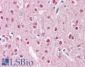 Anti-ZNF238 Antibody (aa107-156) IHC-plus LS-B8070