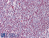 Anti-IKZF3 / AIOLOS Antibody (N-Terminus) IHC-plus LS-B8074
