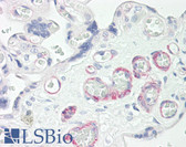 Anti-ZNF322 Antibody (C-Terminus) IHC-plus LS-B8076