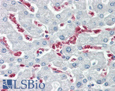 Anti-KARS Antibody (C-Terminus) IHC-plus LS-B8077