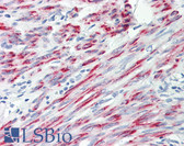Anti-CPEB2 Antibody (aa543-592) IHC-plus LS-B8079