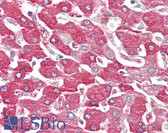 Anti-FBP1 Antibody (aa114-163) IHC-plus LS-B8080