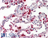 Anti-SFTPB / Surfactant Protein B Antibody (aa194-243) IHC-plus LS-B8081