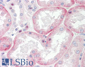 Anti-SLC22A6 Antibody (C-Terminus) IHC-plus LS-B8083