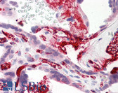 Anti-FGA / Fibrinogen Alpha Antibody (C-Terminus) IHC-plus LS-B8084