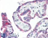 Anti-GPR87 Antibody (N-Terminus) IHC-plus LS-B8094