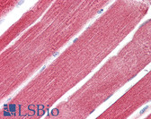 Anti-RHOT1 Antibody (N-Terminus) IHC-plus LS-B8096