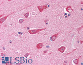 Anti-Neurofibromin / NF1 Antibody (aa27-41, clone McNFn27) IHC-plus LS-B217