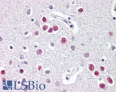 Anti-NR1D1 Antibody (aa290-339) IHC-plus LS-B8100