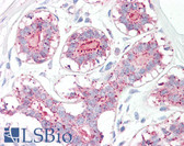 Anti-MAGEA1 / MAGE 1 Antibody (aa38-87) IHC-plus LS-B8102