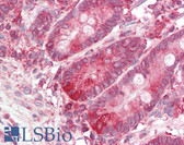 Anti-BCAP31 / BAP31 Antibody (C-Terminus) IHC-plus LS-B8103