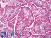 Anti-RAB7A / RAB7 Antibody (Internal, clone EPR7588(B)) IHC-plus LS-B8106