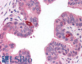 Anti-RNASEL / RNase L Antibody (clone 2E9) IHC-plus LS-B218