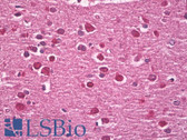 Anti-Neurofibromin / NF1 Antibody (N-Terminus) IHC-plus LS-B8110