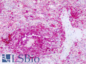 Anti-HLA-DR Antibody (clone LN-3) IHC-plus LS-B8114