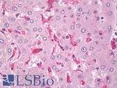Anti-CD33 Antibody (Extracellular Domain, clone EPR4423) IHC-plus LS-B8123