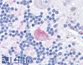 Anti-FXR2 Antibody (aa414-658, clone 1G2) IHC-plus LS-B219