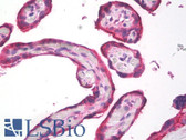 Anti-MMP14 Antibody (Internal, clone EP1264Y) IHC-plus LS-B8126