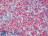 Anti-SLC2A1 / GLUT-1 Antibody (Internal, clone EPR3915) IHC-plus LS-B8130