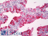 Anti-CD38 Antibody (C-Terminus, clone EPR4106) IHC-plus LS-B8131