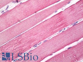 Anti-MYO10 / Myosin-X Antibody (Internal) IHC-plus LS-B8137