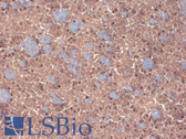 Anti-GABRB3 Antibody (clone S87-25) IHC-plus LS-B8148