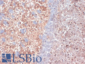 Anti-DLG1 / SAP97 Antibody (clone S64-15) IHC-plus LS-B8156