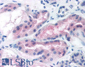 Anti-ABCA7 Antibody (clone 7A1-144) IHC-plus LS-B222