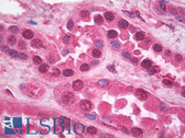 Anti-HSP40 Antibody IHC-plus LS-B8165