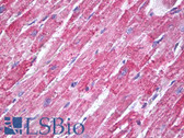 Anti-MNSOD / SOD2 Antibody IHC-plus LS-B8169