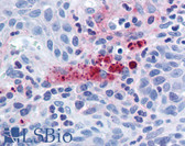 Anti-ACIN1 / Acinus Antibody (C-Terminus) IHC-plus LS-B224