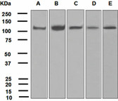 Anti-USP11 Antibody (Internal, clone EPR4346) IHC-plus LS-B8174