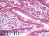 Anti-SDC1 / Syndecan 1 / CD138 Antibody (Internal) IHC-plus LS-B8176