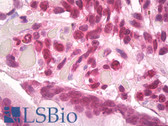 Anti-FUS / TLS Antibody (aa1-50) IHC-plus LS-B8180