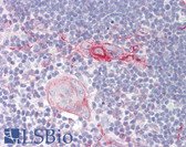 Anti-CRF2-12 / IL28RA Antibody (aa51-100) IHC-plus LS-B8186