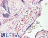 Anti-TEM7 Antibody (aa74-123) IHC-plus LS-B8190