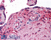 Anti-VG5Q / AGGF1 Antibody (aa500-600) IHC-plus LS-B226