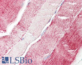 Anti-XYLT2 Antibody (aa722-771) IHC-plus LS-B8195