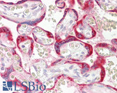 Anti-CYTB / MT-CYB Antibody (N-Terminus) IHC-plus LS-B8199