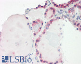 Anti-LEREPO4 / ZC3H15 Antibody (aa290-339) IHC-plus LS-B8200
